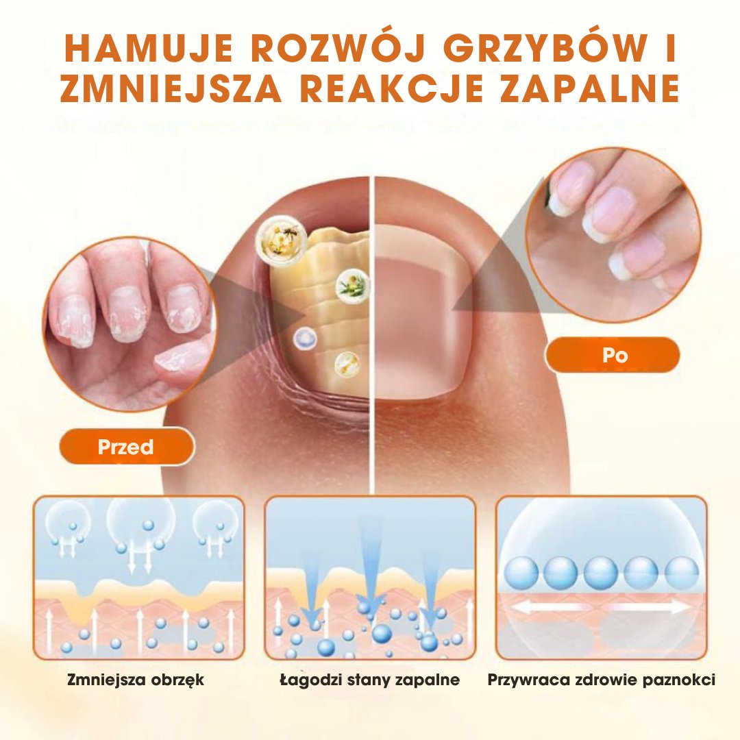 FungiBee™ - Zaawansowany spray do regeneracji paznokci - 1+1 GRATIS