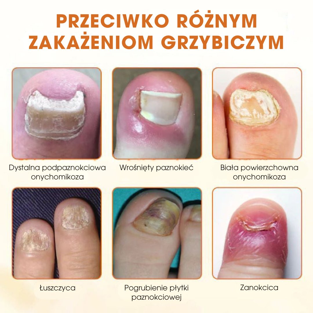 FungiBee™ - Zaawansowany spray do regeneracji paznokci - 1+1 GRATIS