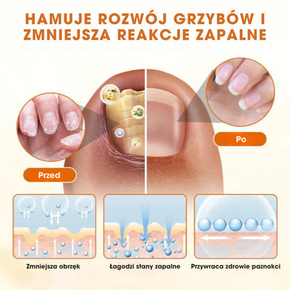 FungiBee™ - Zaawansowany spray do regeneracji paznokci - 1+1 GRATIS