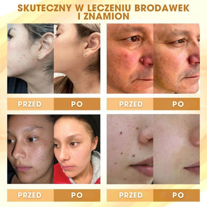 Mellifera Venom™ - Krem naprawczy z jadem pszczelim - 1+1 GRATIS