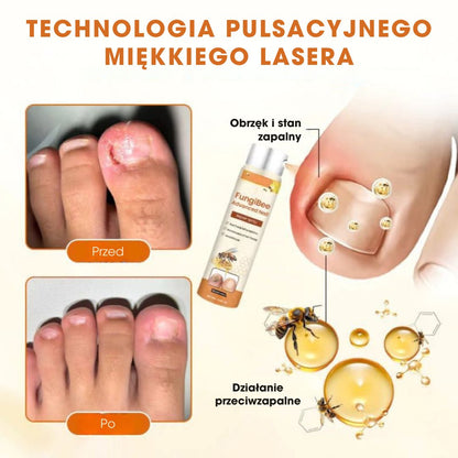 FungiBee™ - Zaawansowany spray do regeneracji paznokci - 1+1 GRATIS
