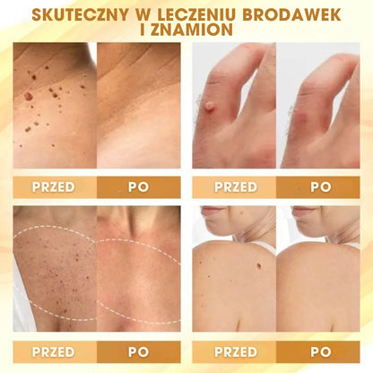 Mellifera Venom™ - Krem naprawczy z jadem pszczelim - 1+1 GRATIS