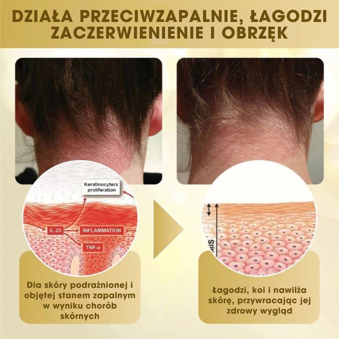 Mellifera Venom™ - Krem naprawczy z jadem pszczelim - 1+1 GRATIS